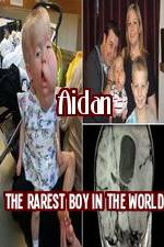 Watch Aidan The Rarest Boy In The World 123netflix