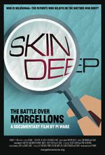 Watch Skin Deep: The Battle Over Morgellons 123netflix