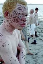 Watch Albino United 123netflix