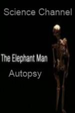 Watch Science Channel Elephant Man Autopsy 123netflix