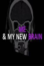 Watch Me & My New Brain 123netflix