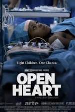Watch Open Heart 123netflix