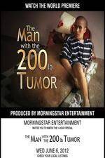 Watch The Man With The 200lb Tumor 123netflix
