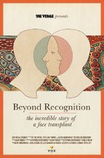 Watch Beyond Recognition: The Incredible Story of a Face Transplant 123netflix