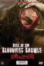 Watch TNA Wrestling: Best of the Bloodiest Brawls - Scars and Stitches 123netflix