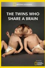 Watch National Geographic The Twins Who Share A Brain 123netflix