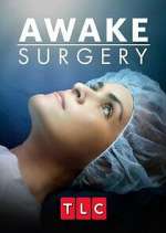 Watch Awake Surgery 123netflix